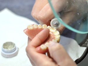 義歯のメンテナンス